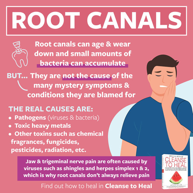 Root Canals