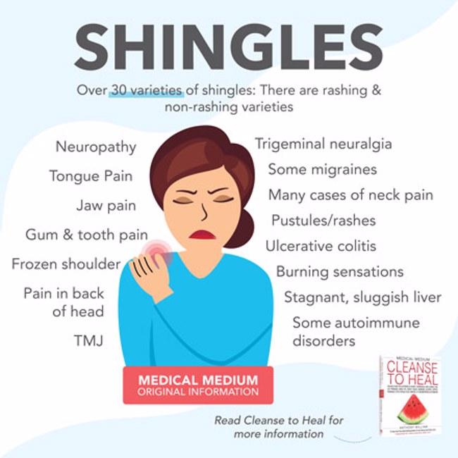 Shingles 