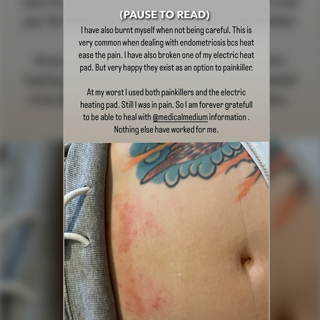 My Medical Medium Healing Journey—Lyme, Endometriosis