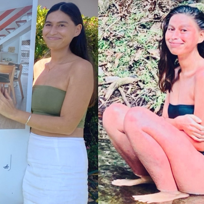 Life-Changing Protocols Healing Eczema